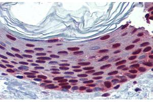 Immunohistochemistry with Human Skin lysate tissue at an antibody concentration of 5. (SLC35A5 antibody  (N-Term))