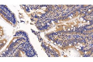 Immunohistochemistry (IHC) image for anti-alpha-2-Macroglobulin (A2M) (AA 616-856) antibody (ABIN7429073)
