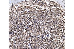 IHC analysis of NOLA1/GAR1 using anti-NOLA1/GAR1 antibody (ABIN7602076). (GAR1 antibody  (AA 58-165))