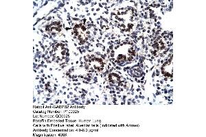 Human Lung (GABPB2 antibody  (C-Term))