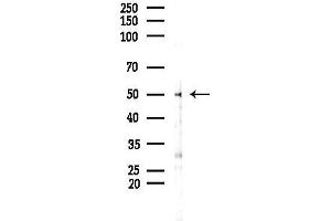 anti-RELT Tumor Necrosis Factor Receptor (RELT) (C-Term) antibody