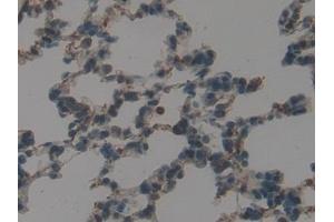 Detection of GATA4 in Rat Lung Tissue using Polyclonal Antibody to GATA Binding Protein 4 (GATA4) (GATA4 antibody  (AA 228-440))