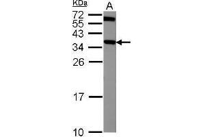 WB Image Sample (50 ug of whole cell lysate) A: Mouse brain 12% SDS PAGE antibody diluted at 1:1000 (CRYM antibody)
