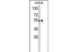 Western blot analysis of BCKDHA Antibody (C-term) (ABIN390811 and ABIN2841048) in Jurkat cell line lysates (35 μg/lane).