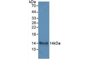 Detection of Recombinant IL33, Human using Monoclonal Antibody to Interleukin 33 (IL33) (IL-33 antibody  (AA 112-270))