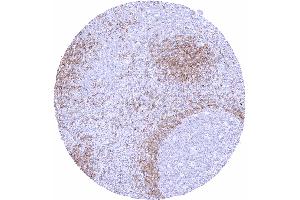 Tonsil Strong IgD staining in a fraction of B lymphocytes especially in the mantle zone (Recombinant IgD antibody)
