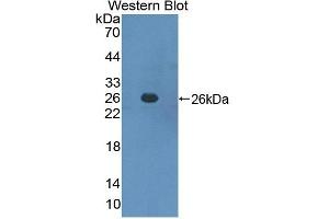 Detection of Recombinant SOCS3, Mouse using Polyclonal Antibody to Suppressors Of Cytokine Signaling 3 (SOCS3) (SOCS3 antibody  (AA 1-225))