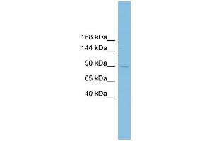 XRRA1 antibody used at 1 ug/ml to detect target protein. (XRRA1 antibody  (N-Term))