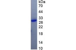 SDS-PAGE (SDS) image for SARS-CoV-2 Spike S1 protein (ABIN6952680) (SARS-CoV-2 Spike S1 Protein)