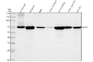 Western blot analysis of AIF using anti-AIF antibody (ABIN3043779).