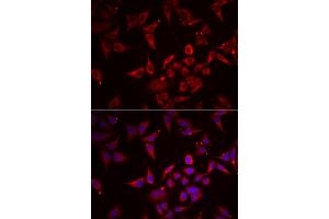 Immunofluorescence analysis of U2OS cells using NCR3 antibody. (NCR3 antibody)