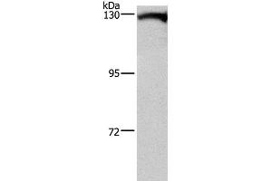 Western Blot analysis of Human testis tissue using DAAM1 Polyclonal Antibody at dilution of 1:400