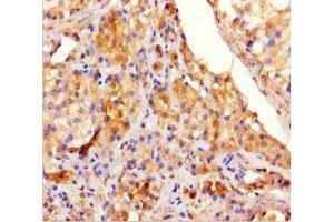 Immunohistochemistry of paraffin-embedded human testis tissue using ABIN7171822 at dilution of 1:100 (TEX13A antibody  (AA 116-380))