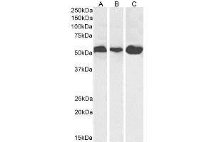 Western Blot using anti-Alpha-Tubulin antibody F2C. (Recombinant alpha Tubulin antibody)