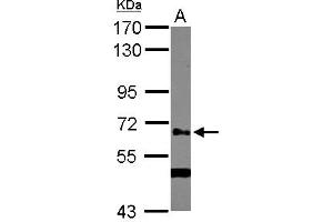 Western Blotting (WB) image for anti-UDP-N-Acetyl-alpha-D-Galactosamine:polypeptide N-Acetylgalactosaminyltransferase 14 (GalNAc-T14) (GALNT14) (AA 1-189) antibody (ABIN1498369) (GALNT14 antibody  (AA 1-189))