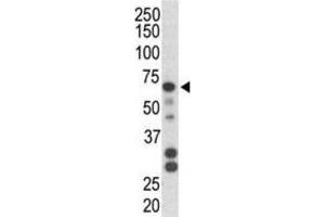 Western Blotting (WB) image for anti-Parkinson Protein 2, E3 Ubiquitin Protein Ligase (Parkin) (PARK2) antibody (ABIN3002636) (Parkin antibody)