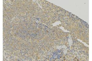 ABIN6272897 at 1/100 staining Human lymph node tissue by IHC-P. (TAGLN2 antibody  (Internal Region))
