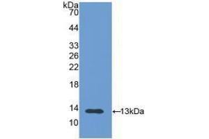Western blot analysis of recombinant Human PIGR. (PIGR antibody  (AA 19-120))