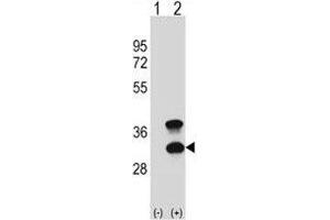 Western blot analysis of CD79b antibody and 293 cell lysate (2 ug/lane) either nontransfected (Lane 1) or transiently transfected (2) with the CD79B gene. (CD79b antibody  (AA 93-121))
