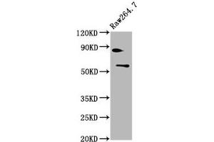 Western Blot Positive WB detected in: Raw264. (SMARCD2 antibody  (AA 1-113))