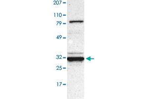 Western Blot (Cell lysate) analysis of human cell line RT-4 with GNPDA1 polyclonal antibody  at 1:250 - 1:500 dilution. (GNPDA1 antibody)