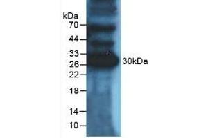 Detection of PDL1 in Mouse Heart Tissue using Polyclonal Antibody to Programmed Cell Death Protein 1 Ligand 1 (PDL1) (PD-L1 antibody  (AA 48-290))