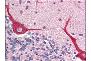 Image no. 1 for anti-Interleukin 23, alpha subunit p19 (IL23A) (N-Term) antibody (ABIN303269) (IL23A antibody  (N-Term))