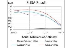 Black line: Control Antigen (100 ng), Purple line: Antigen(10 ng), Blue line: Antigen (50 ng), Red line: Antigen (100 ng), (GAB2 antibody  (AA 332-476))