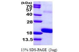 SDS-PAGE (SDS) image for Smad Nuclear Interacting Protein 1 (SNIP1) (AA 258-396) protein (His tag) (ABIN667459) (SNIP1 Protein (AA 258-396) (His tag))