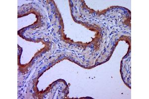 Paraformaldehyde-fixed, paraffin embedded rat bladder, Antigen retrieval by boiling in sodium citrate buffer (pH6. (Claudin 1 antibody  (AA 121-211))