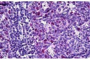 Human Tonsil: Formalin-Fixed, Paraffin-Embedded (FFPE) (TPX2 antibody  (AA 301-350))