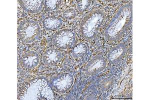 IHC analysis of PTRF/CAVIN1 using anti-PTRF/CAVIN1 antibody (ABIN7601817).