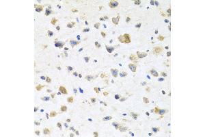 Immunohistochemistry of paraffin-embedded mouse brain using PGR antibody at dilution of 1:100 (x40 lens). (Progesterone Receptor antibody)