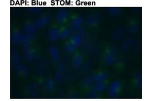 Immunofluorescent staining of HeLa cells with STOM polyclonal antibody  at 1:150 dilution. (Stomatin antibody  (C-Term))