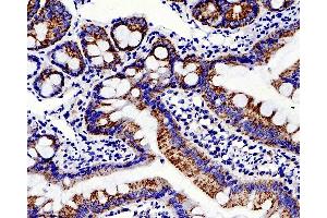 Immunohistochemistry analysis of paraffin-embedded rat colon using MMP2 Polyclonal Antibody at dilution of 1:500. (MMP2 antibody)