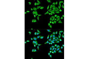 Immunofluorescence analysis of MCF-7 cells using CES2 antibody (ABIN5970708). (CES2 antibody)