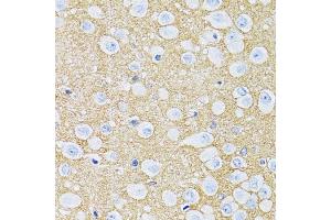 Immunohistochemistry of paraffin-embedded rat brain using SLC1A2 antibody (ABIN2736671) at dilution of 1:100 (40x lens).