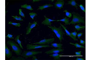 Immunofluorescence of monoclonal antibody to USP9X on HeLa cell. (USP9X antibody  (AA 1-90))