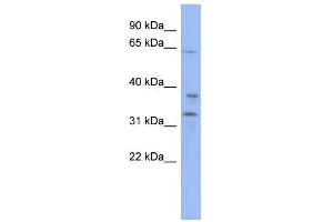 WB Suggested Anti-KBTBD5 Antibody Titration:  0. (KBTBD5 antibody  (Middle Region))