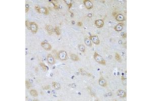 Immunohistochemistry of paraffin-embedded mouse brain using TMOD3 antibody. (TMOD3 antibody)