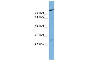 WB Suggested Anti-C6orf10 Antibody Titration:  0. (CDNA Sequence BC051142 (BC051142) (Middle Region) antibody)