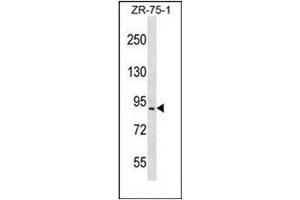 Western blot analysis of HRC / HCR Antibody (Center) in ZR-75-1 cell line lysates (35ug/lane).