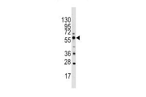 Western blot analysis of PIST Antibody (C-term) (ABIN391394 and ABIN2841398) in Ramos cell line lysates (35 μg/lane). (GOPC antibody  (C-Term))
