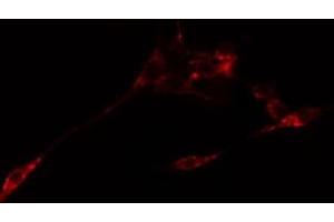 ABIN6274766 staining Hela cells by IF/ICC. (RPL10L antibody  (C-Term))