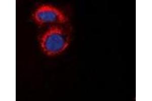 Immunofluorescent analysis of mPR alpha staining in A549 cells. (PAQR7 antibody  (C-Term))
