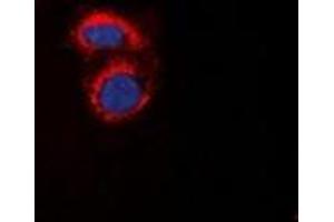 Immunofluorescent analysis of mPR alpha staining in A549 cells.