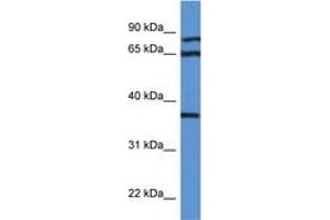 Image no. 1 for anti-Deoxyhypusine Synthase (DHPS) (AA 51-100) antibody (ABIN6746962) (DHPS antibody  (AA 51-100))