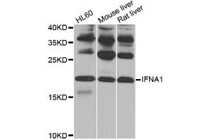 Western blot analysis of extracts of various cell lines, using IFNA1 antibody (ABIN1873146) at 1:1000 dilution. (IFNA1 antibody)