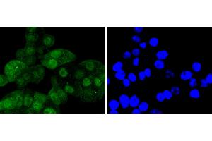 SW480 cells were stained with Cdk6 (4F7) Monoclonal Antibody  at [1:200] incubated overnight at 4C, followed by secondary antibody incubation, DAPI staining of the nuclei and detection. (CDK6 antibody)