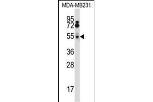 HTRA2 Antibody (N-term) (ABIN657628 and ABIN2846624) western blot analysis in MDA-M cell line lysates (35 μg/lane). (HTRA2 antibody  (N-Term))
